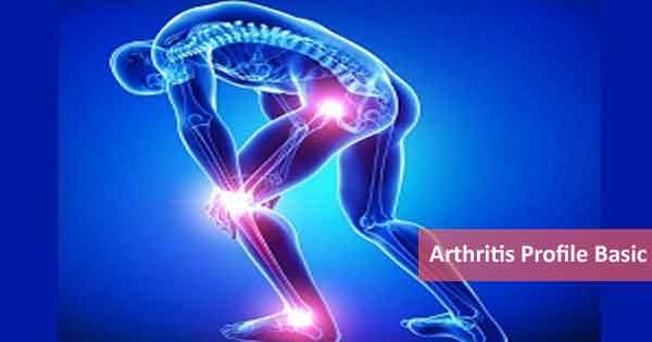 Arthritis Profile