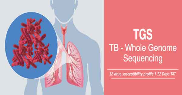 Tuberculosis - Diagnosis and treatment